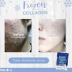 Frozen Collagen and Glutathione Dietary Supplement 60 caps